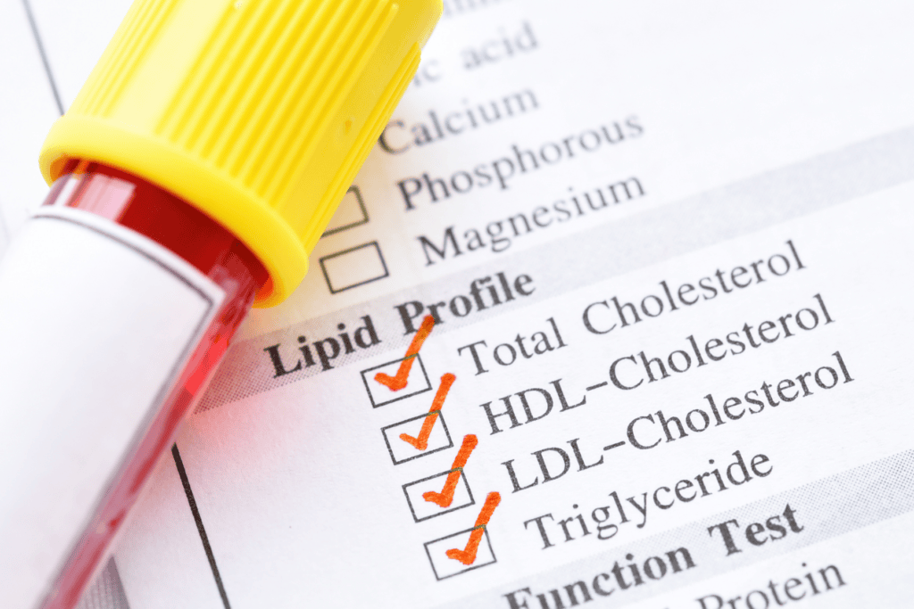 Cholesterol in midlife